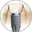 Dentistes Crolles